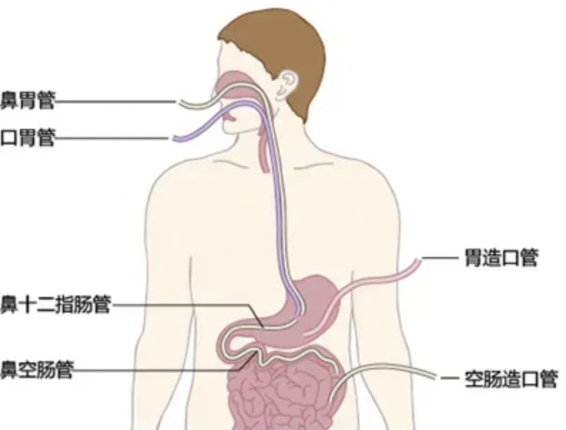每日一题_2022.07.26