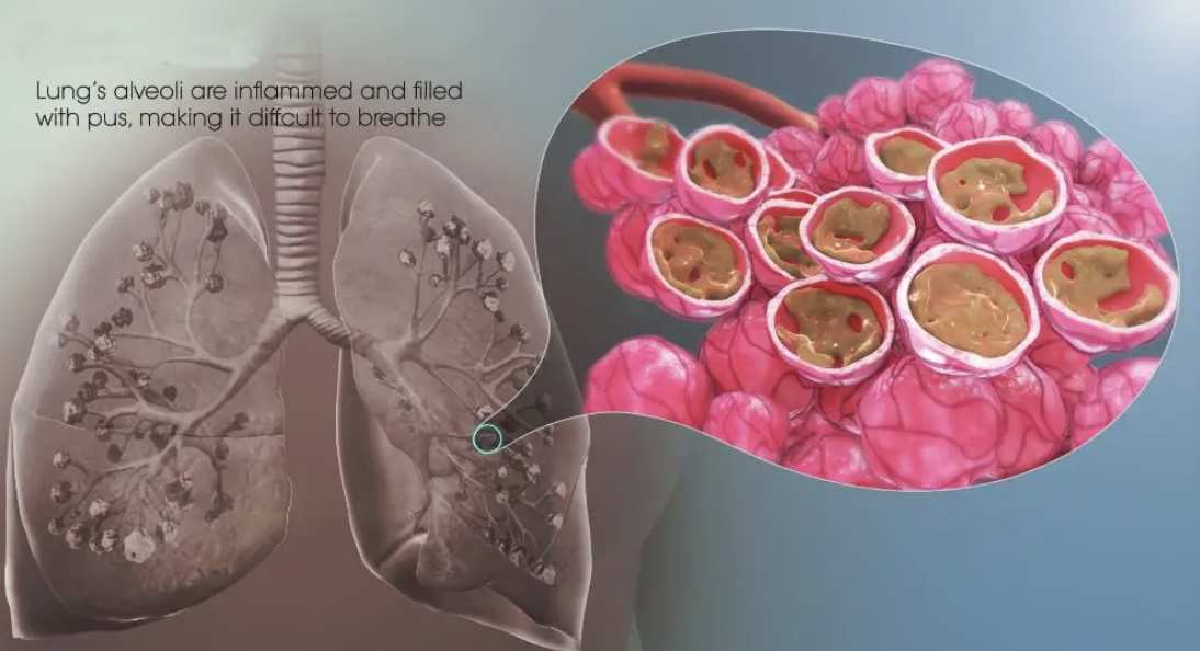 每日一题_2022.07.30