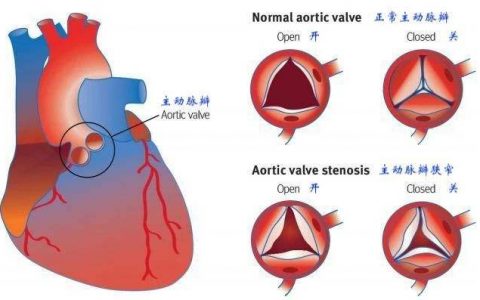 每日一题_2022.07.29