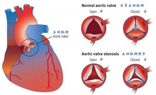 每日一题_2022.07.29