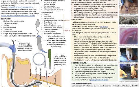 ICU OnePager：经皮气管切开