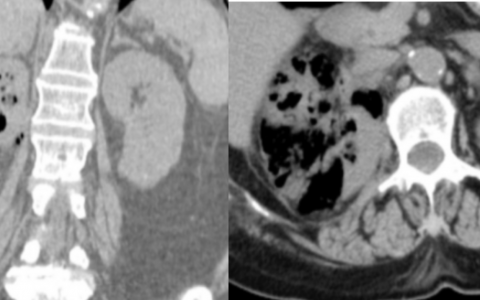 每日一题_2022.07.31
