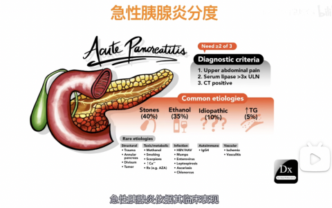 协和八：急性胰腺炎