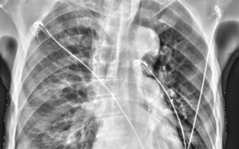 每日一题_2022.08.04