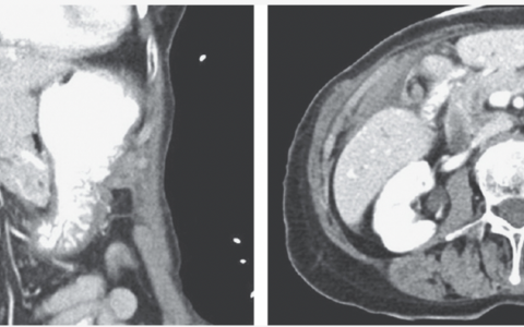 每日一题_2022.08.12