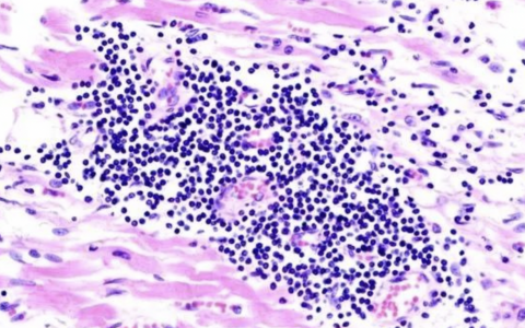 每日一题_2022.08.16