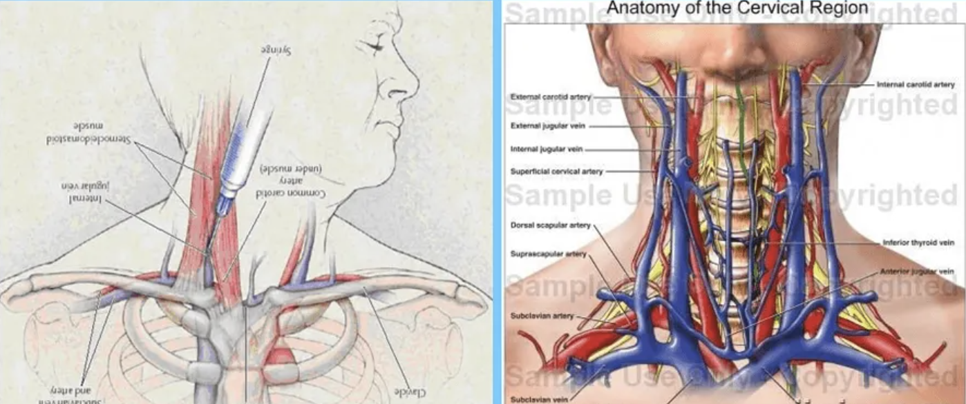 每日一题_2022.08.17