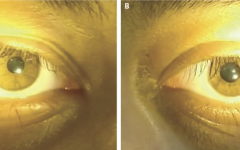 每日一题_2022.08.19