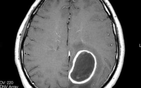 每日一题_2022.08.29