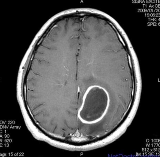 每日一题_2022.08.29