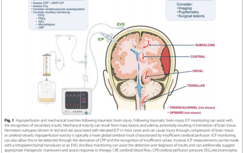 每日一题_2022.08.08
