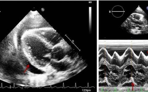 每日一题_2022.09.11