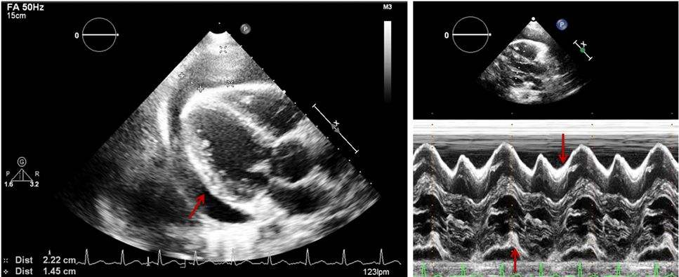 每日一题_2022.09.11