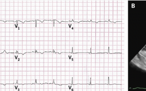每日一题_2022.09.02