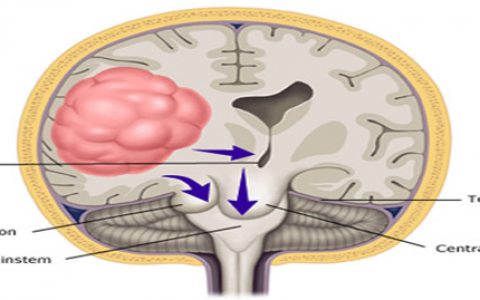 每日一题_2022.09.28