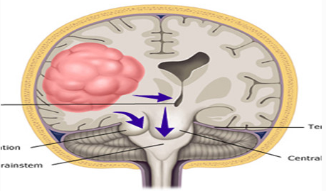 每日一题_2022.09.28