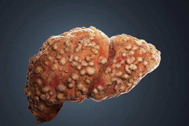 每日一题_2022.09.16