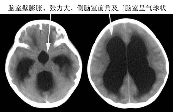 每日一题_2022.09.01