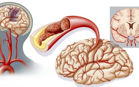 每日一题_2022.09.14