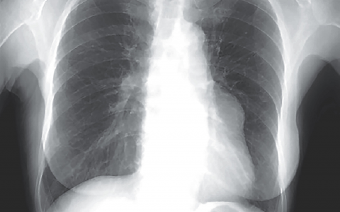 每日一题_2022.09.10