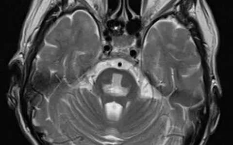 每日一题_2022.09.12