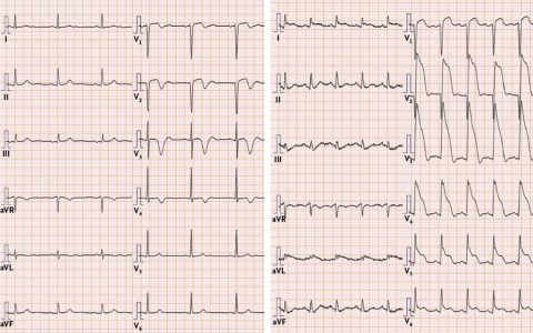 每日一题_2022.09.19