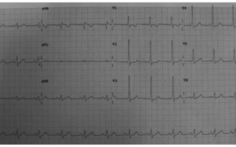 每日一题_2022.10.09