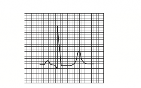 每日一题_2022.10.10