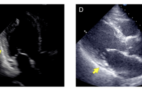 每日一题_2022.10.11