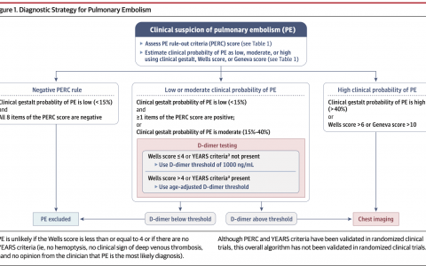 JAMA：急性肺栓塞