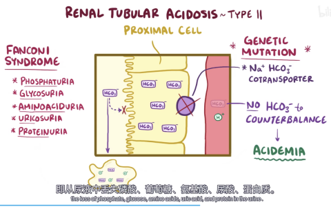 【Osmosis】肾小管性酸中毒
