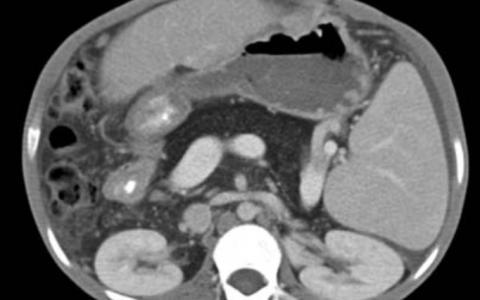 每日一题_2022.10.25