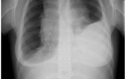 每日一题_2022.10.26