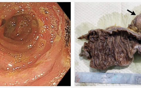 每日一题_2022.10.30