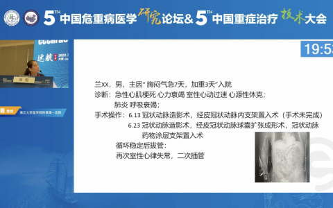 脓毒症相关DIC_浙一郑霞