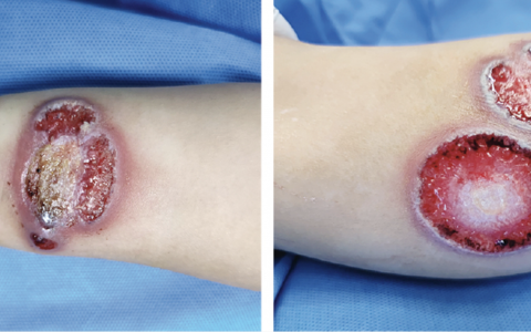 每日一题_2022.11.06