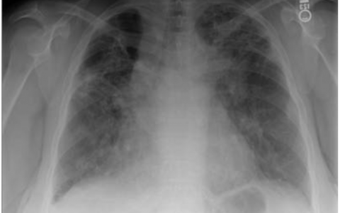 每日一题_2022.11.05