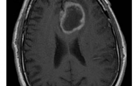 每日一题_2022.11.09