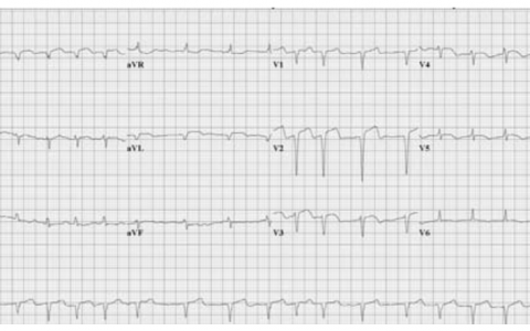 每日一题_2022.11.17