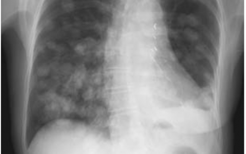 每日一题_2022.11.19