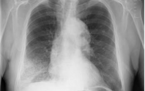 每日一题_2022.11.22