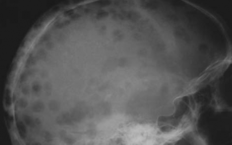 每日一题_2022.11.24