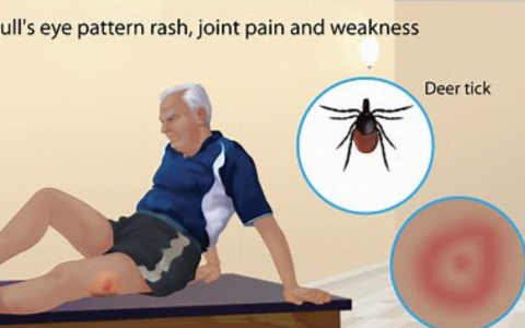 每日一题_2022.11.30