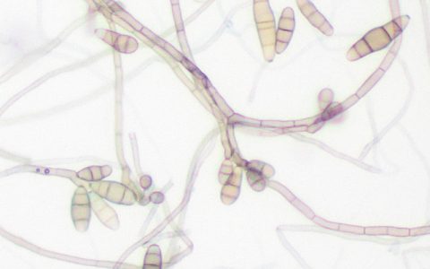 每日一题_2022.11.03