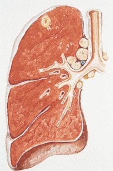 每日一题_2022.11.27