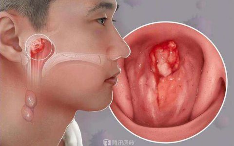 每日一题_2022.11.15