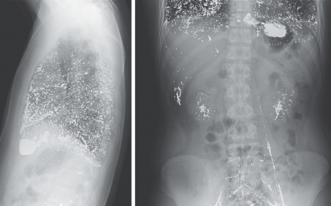每日一题_2022.11.10