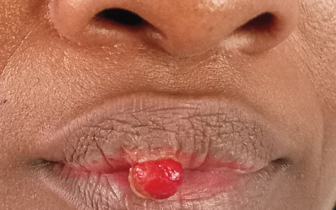 每日一题_2022.11.18