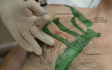 每日一题_2022.11.26