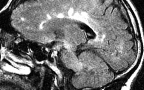 每日一题_2022.12.05